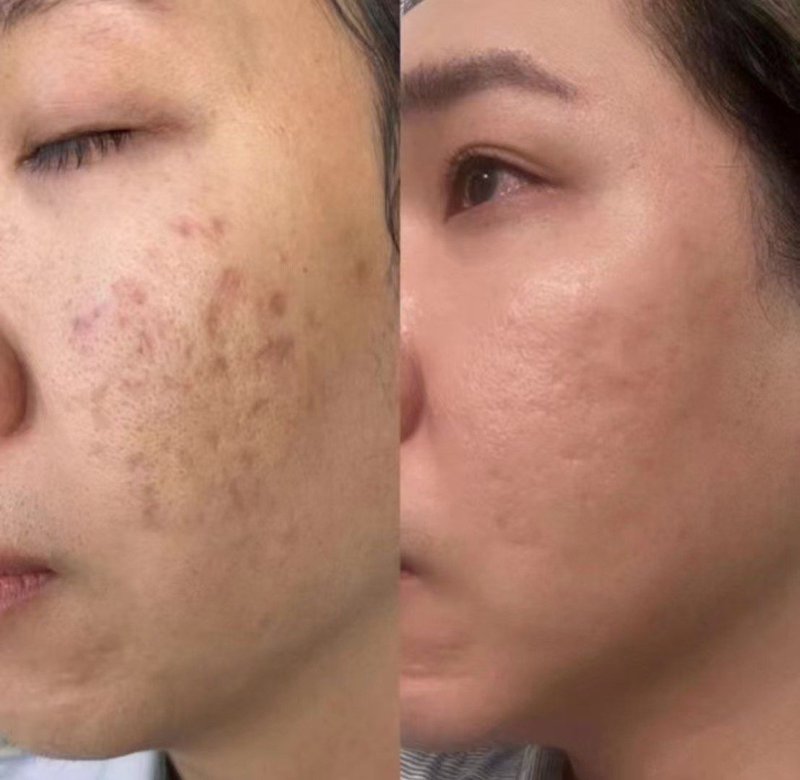 美容护肤新趋势：天然成分引领潮流